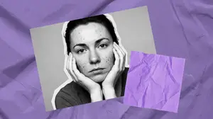 Does Accutane Cause Infertility? What Your Derm Might Not Tell You