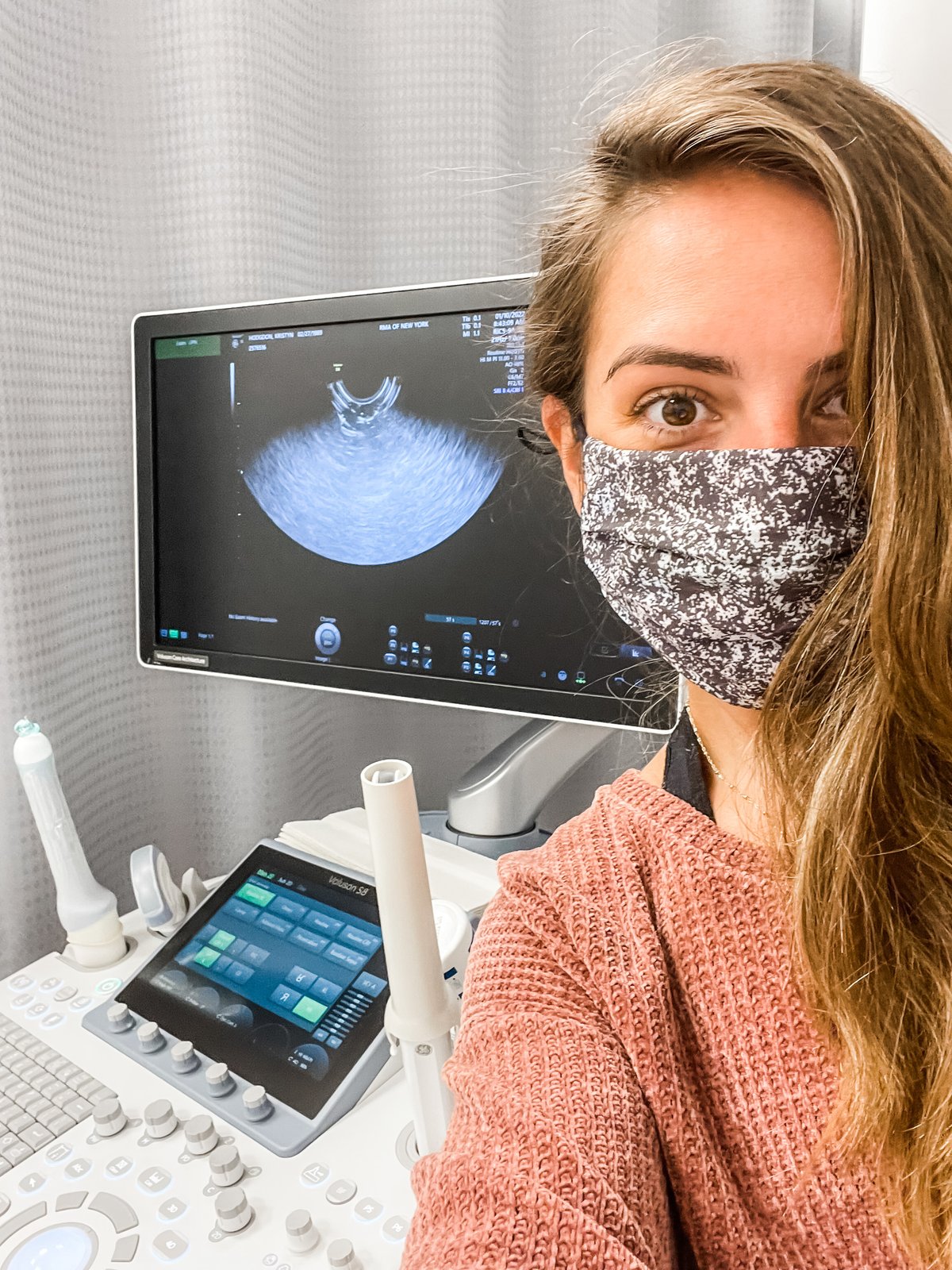 Four Kinds of PCOS (And Why That Feels Hopeful)