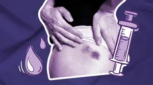 woman getting a progesterone in oil shot during ivf