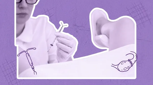 doctor inserting an iud